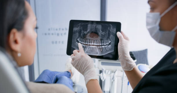 Licensed Dental Veneers service in Brittany Farms-The Highlands, PA - Smile Center Dentistry